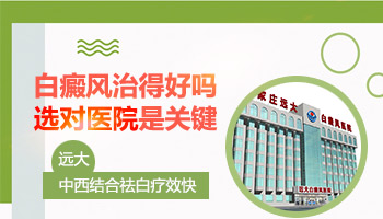 远大白癜风医院怎么样
