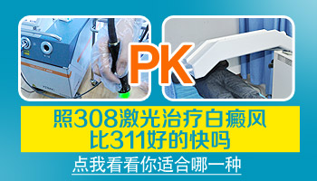 进展期白癜风照311光会扩散吗