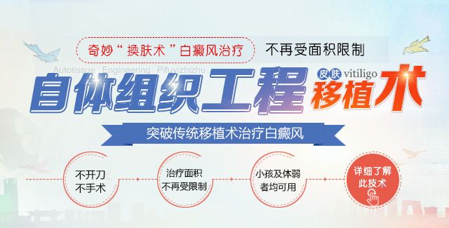 自体组织工程皮肤移植术治白癜风有什么限制吗