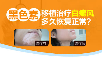白癜风做完植皮手术很黑是变好转吗