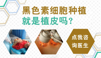 青少年白癜风黑色素培植手术成功率高不高
