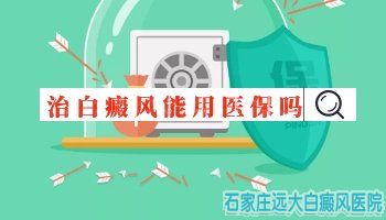 检查白斑是不是白癜风能用社保吗