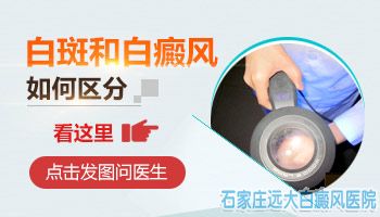 额头上一块很白的皮肤是怎么了