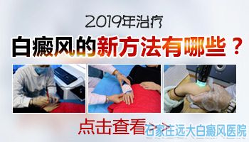 沧州白癜风有效治疗方法