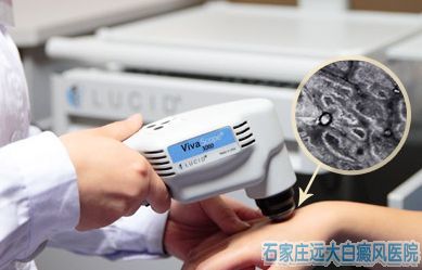 胸前有一块白斑是不是白癜风