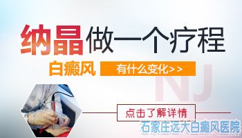 治疗白斑 这些不靠谱的方法一定要避免