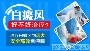 白癜风没有稳定照308有用吗