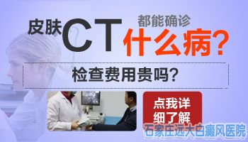 额头上一块很白的皮肤是怎么了