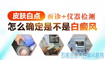 脸上起了白色的斑点是白癜风吗