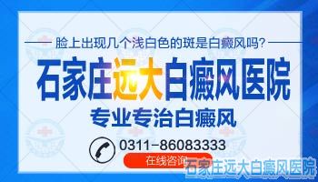 伍德灯下白斑显示无荧光的原因是什么