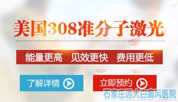 脖子后边有块白斑用什么方法治