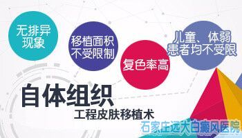 保定治白癜风比较好的方法是什么