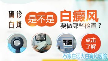 白癜风