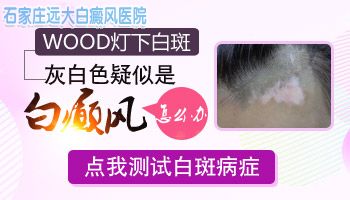四岁孩子脸上白斑像白癜风做伍德灯能检查出来吗