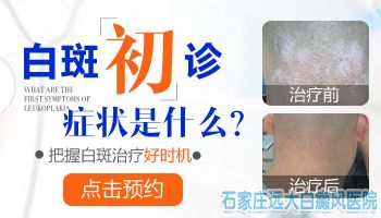 脖子后面有几块皮肤发白是不是白癜风