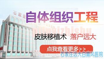 大面积白斑没救了 那是你不知道还有这一招
