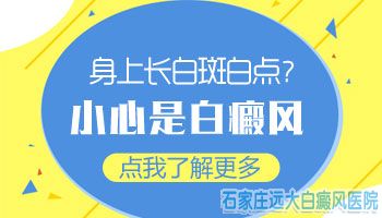 手上长白点没有整体变白算白癜风吗