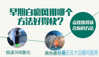突然长的白癜风怎么治能好