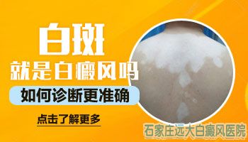 3个月婴儿脖子上出白斑是怎么了