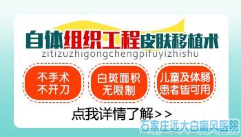 有什么方法可以快速治好后背的白癜风