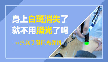 白斑照了几次308缩小了还用照吗