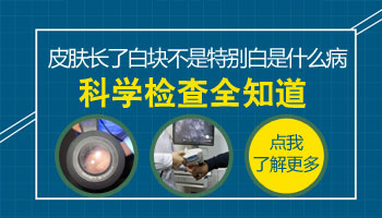 四周半孩子脸上长白斑怎么回事