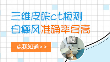 孩子脸上一块白是得了什么病