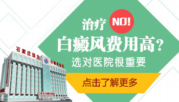 2019年白癜风国家免费治疗是真的吗