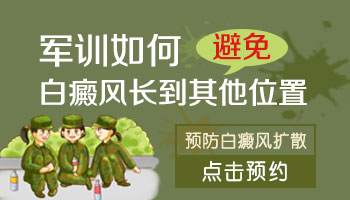 有白癜风还能不能参加军训