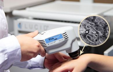 为什么后期白癜风恢复就变慢了