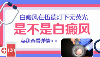 伍德灯下不发光的白斑是白癜风吗
