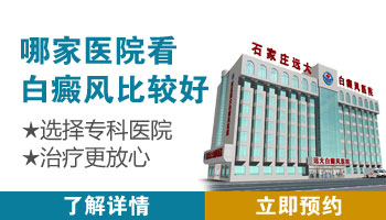 邯郸治白癜风的外用药哪里有卖的