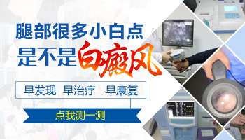腿上出了三个白点儿是不是白癜风