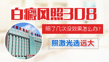 白癜风照308激光不见好怎么办