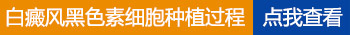 衡水手术治疗白癜风贵吗