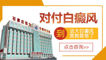 白癜风做纳晶定向有没有效果 效果好吗