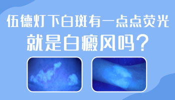 手关节处有白色圆点伍德灯下是荧光白代表什么
