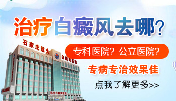 廊坊白癜风医院植皮效果怎么样