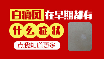 皮肤出现白斑还变大要小心是白癜风