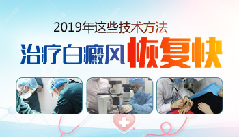 2019白癜风治疗方法哪一个好用