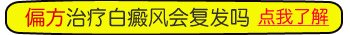 白癜风治好后又复发了该怎么办