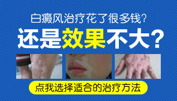 看完这个 就知道自己的白斑治疗为什么没效果了