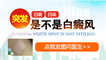 下巴处出现了两块白块是不是白癜风