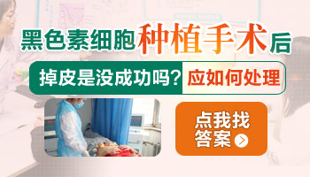 白癜风皮肤移植一平方厘米多少钱