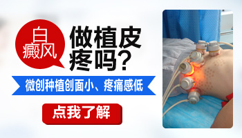 白斑植皮疼不疼 能保证植皮成功吗