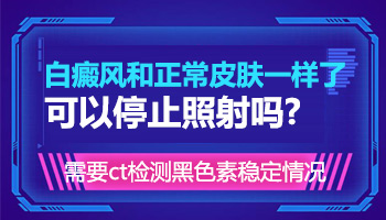 儿童眼眶白癜风做308激光有些地方明显好转还用照吗
