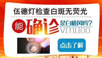 白癜风在伍德灯下发白但无荧光图片