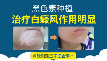 额头有白斑能做黑色素细胞移植手术吗