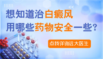 治疗白癜风的外用药哪个效果好