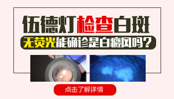 伍德灯下无荧光的白斑是白癜风吗